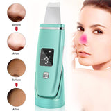 Ultrasonic Deep Cleansing Face Scrubber